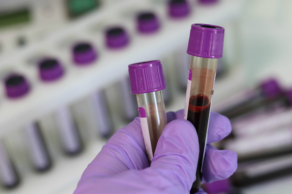 blood samples in a laboratory